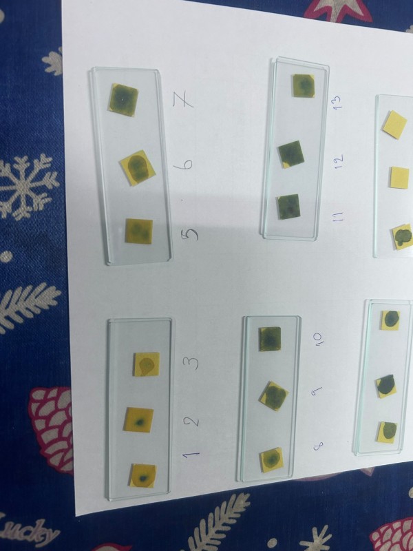 4 มี.ค.68 รพ.สต.บ้านสันป่าไร่ จัดกิจกรรมโครงการตรวจสารเคมีตกค้างในเลือดกลุ่มวัยทำงาน งบกองทุนหลักประกันสุขภาพ โดยมีกิจกรรม เจาะเลือด , จ่ายยาสมุนไพรชาชงรางจืด ผู้ร่วมกิจกรรม 100 คน 