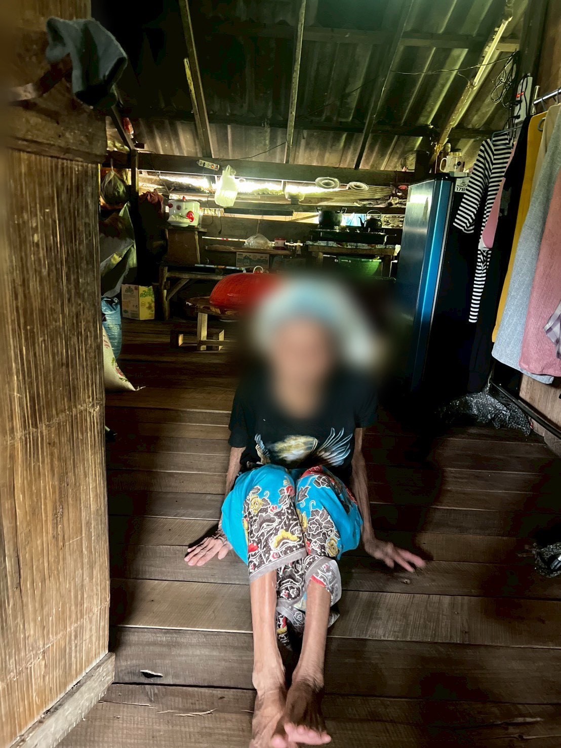 8 ตุลาคม 2568 นางอัจฉรา ทวีเกื้อกูลกิจ นายกองค์การบริหารส่วนจังหวัดตาก มอบหมายให้ นางสาววาสนา กึกก้องโลกา พยาบาลวิชาชีพปฏิบัติการ และนางสาวโสภา วรนารถวิชัย ผู้ช่วยทันตกรรม รพ.สต.บ้านสันป่าไร่ เยี่ยมบ้านผู้ป่วยหลอดเลือดสมอง หลังได้รับการผ่าตัดสมอง จำนวน 1 