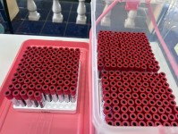 3 ก.ค.68 รพ.สต.บ้านสันป่าไร่ รณรงค์ตรวจคัดกรองไวรัสตับอักเสบบีและซี โดยการเจาะเลือด ให้แก่กลุ่มเป้าหมาย อายุ 34 ปีขึ้นไป